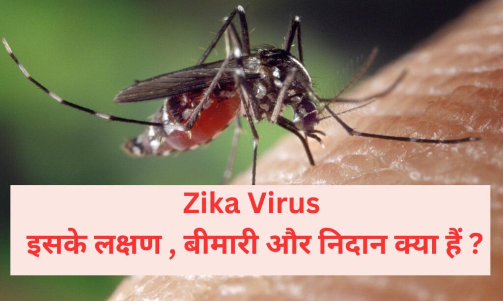 Zika Virus